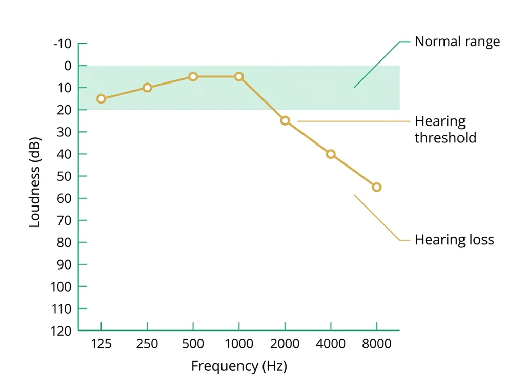 Labeled illustration: audiogram
