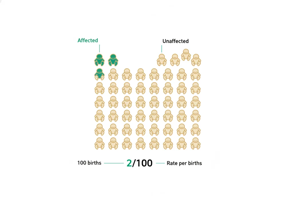 Labeled illustration: birth prevalence