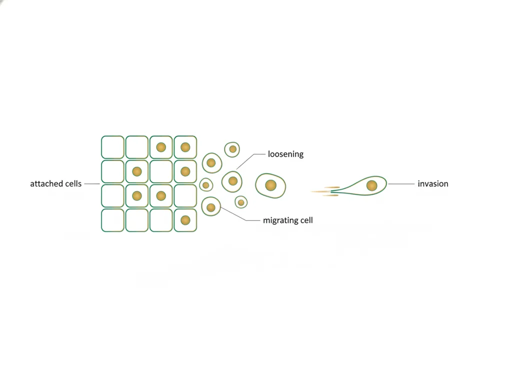 Labeled illustration: EMT